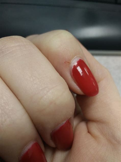 Help! How can I remove this without excruciating pain? : r/SoakOff