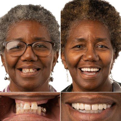 JAX DENTAL IMPLANTS & DENTURES - Updated May 2025 - 31 Photos & 12 ...