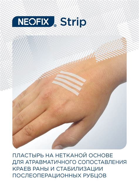 NEOFIX® Strip - АТЕКС ГРУПП