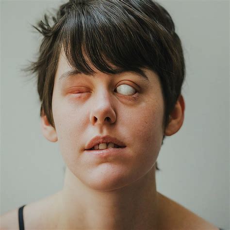eyed blind girl  steveh  deviantart
