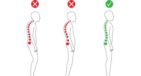types  posture