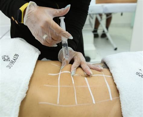Hidrolipo Como E Feito - Hidrolipo Brasilia - Duohaus