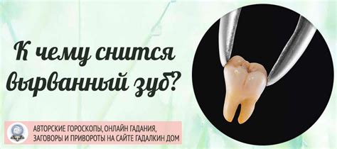 Сонник: вырванный зуб