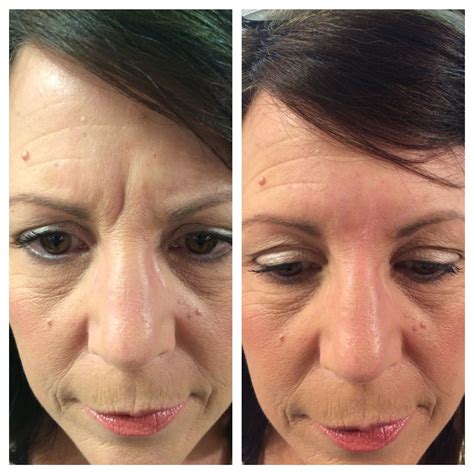 cover scars makeup 7