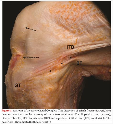 Patella Anatomy Patella Anatomy | Patella Kneecap Bone Review