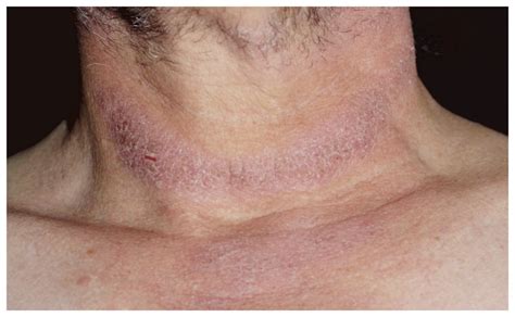 D Is for Delay | NEJM