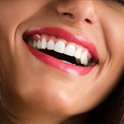 Keep Your White Smile This New Year! - Family Dentistry of Columbus