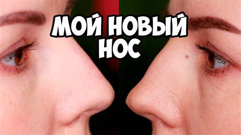 КОНТУРНАЯ ПЛАСТИКА БЕЗ ОПЕРАЦИИ | У МЕНЯ НОВЫЙ НОС!! - YouTube