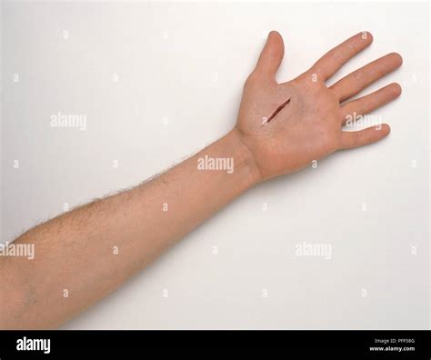 Deep cut on palm of hand Stock Photo - Alamy