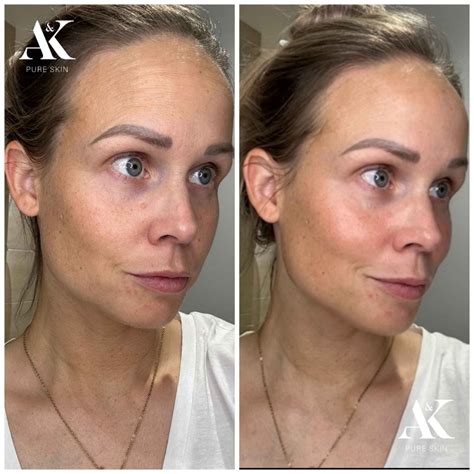 best face oil for gua sha 2