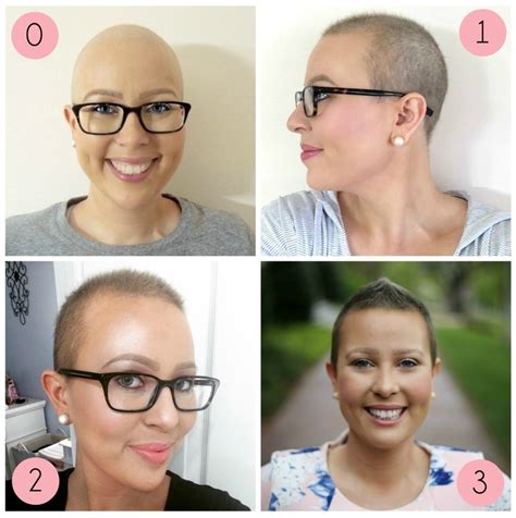 how to grow out hair after chemo