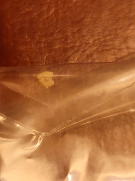 soft white clumpy stuff   passed rkidneystones