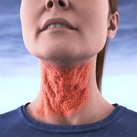Premium AI Image | Sore throat pharyngitis illness cold infection red ...