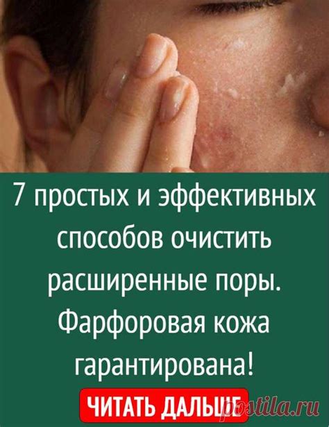 7 простых и эффективных способов очистить расширенные поры. Фарфорова ...