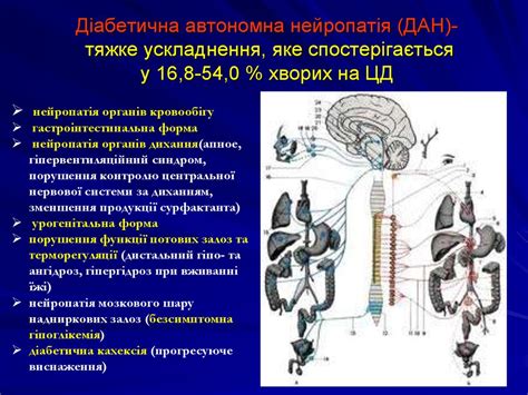 Цукровий діабет 1 і 2 типу. Етіологія, патогенез, клініка, діагностика ...