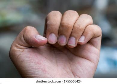3+ Thousand Men With Long Nails Royalty-Free Images, Stock Photos ...