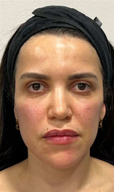 Jw Woodward: Before and After Photos That Will Amaze You! - 0cqpb74