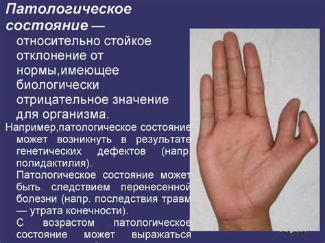 Нозология. Учение о болезни. Определение понятия «болезнь ...