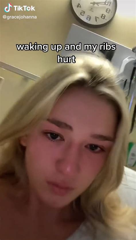 My lung 'spontaneously collapsed' vaping, I could have died | New York Post