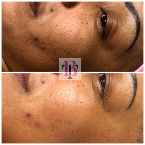 Get the Glow! Book a HydraGlow Facial Today! | Facial, Behind ear