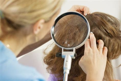 Body Lice: Symptoms, Causes, Treatment, and Prevention - Health & Detox & Vitamins