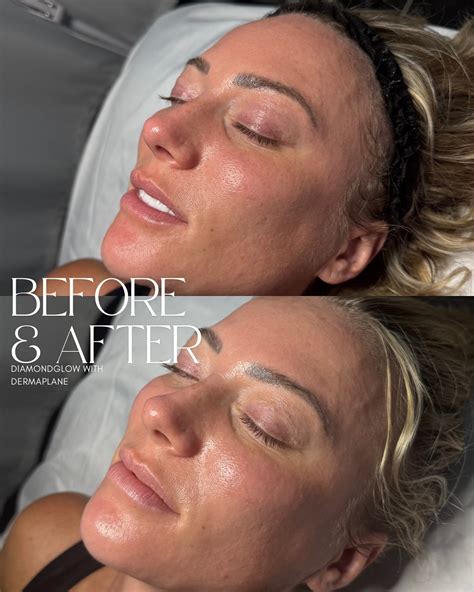 Erica Suess (@ericacassandraskin) • Instagram photos and videos