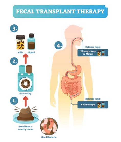 fecal transplantation sciences dirty secret omixon