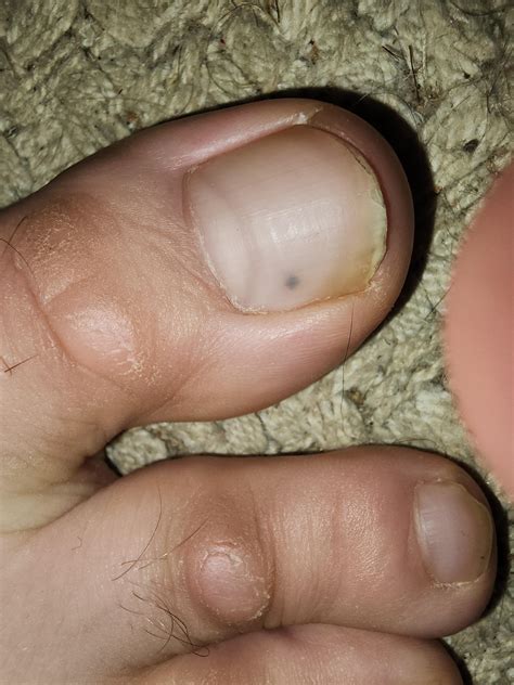 Had this tiny dark spot pop up under my toenail. What could this be