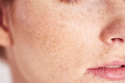 How does the skin function? Urgo Medical will tell you more about it.