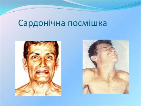 правець