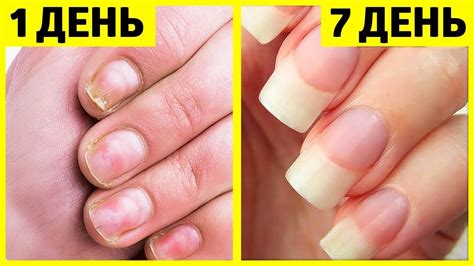 6 секретов ухода за ногтями