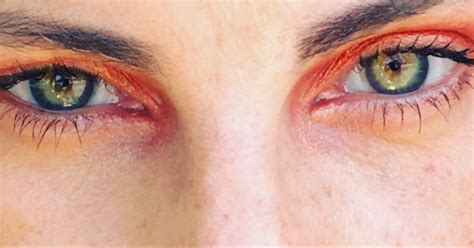 Heterochromia Heterochromia is fairly uncommon, occurring in less than ...