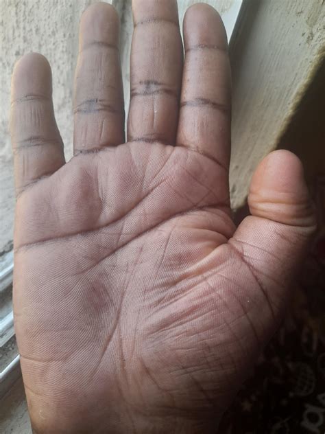 a life is on the line 2