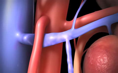 Obstructive venous diseases | ABC Medical Center