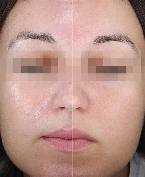 Слънцезащитен гел-крем за лице за мазна кожа SPF 50+ | Eucerin