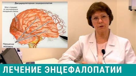 Энцефалопатия головного мозга: что это такое, симптомы, лечение и ...