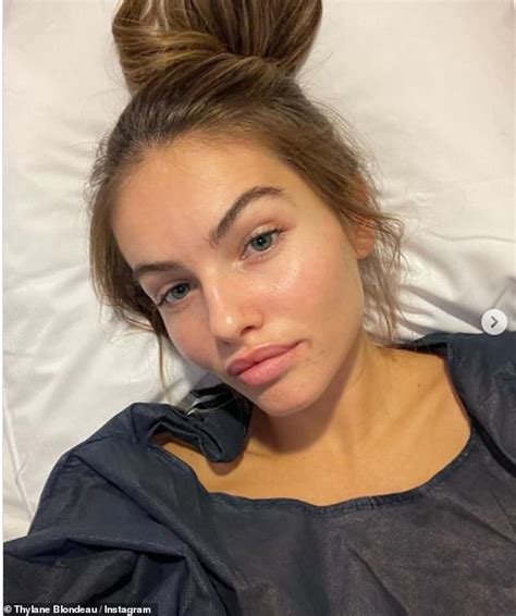 Thylane Blondeau reveals she has had emergency surgery | Daily Mail Online