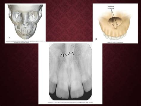 Chapter 27:Normal Anatomy: Intraoral Images