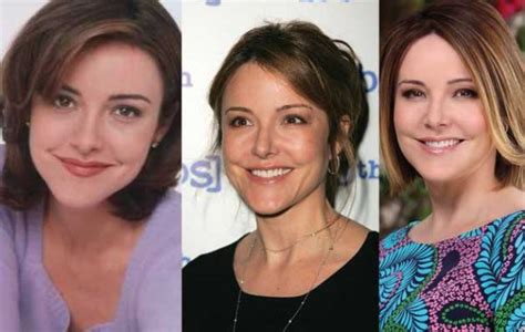 Christa Miller Plastic Surgery Before and After Pictures 2025