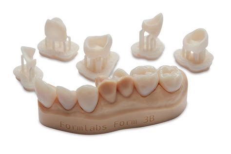 Переваги використання смоли Permanent Crown Resin для друку постійних ...