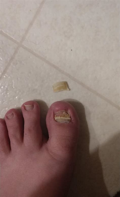 My buddy has bad nails, one came off during freaky time. : r/MakeMeSuffer