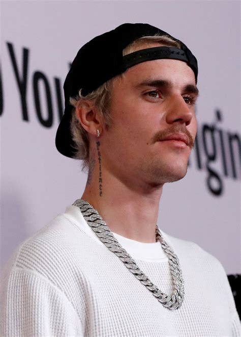 justin bieber face paralysis 5