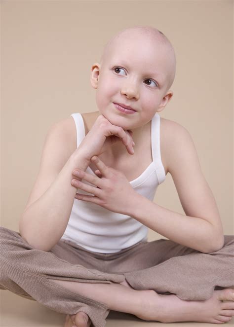 Alopecia Project — Tilly Nelson Commercial Lifestyle & Kids Fashion