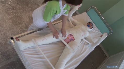 Plaster Full Body cast - YouTube