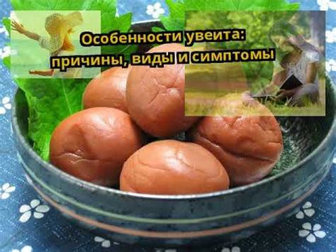 Особенности увеита: причины, виды и симптомы - YouTube