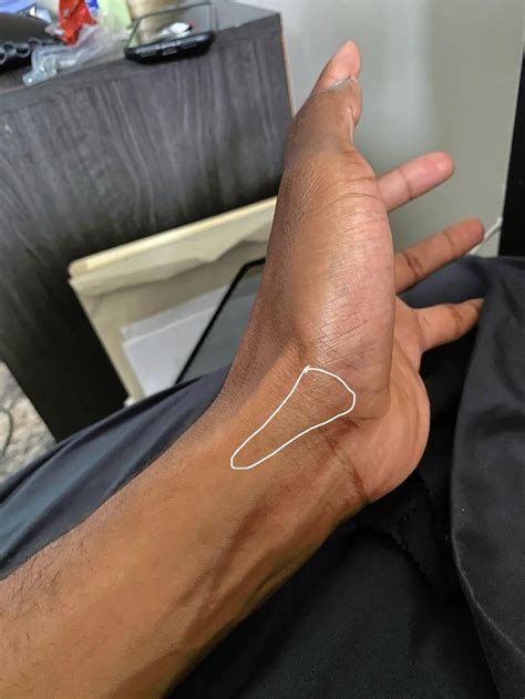 Wrist pain but unsure if it is tendon | Scrolller