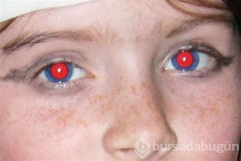 Красные Глаза На Фотографии — Картинки фотографии
