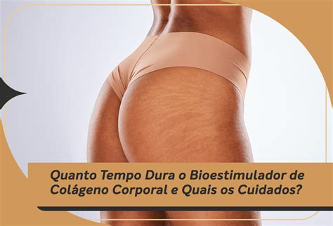 Quanto Tempo Dura O Bioestimulador De Colágeno - Quanto tempo Dura o Bioestimulador de colágeno corporal e quais os ...