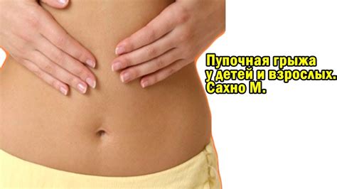 Пупочная грыжа у детей и взрослых. Сахно М. - YouTube