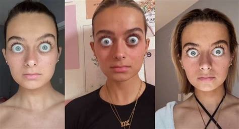 Pessoa Com Olho Grande - Vídeo: mulher viraliza na internet por causa de olhos enormes